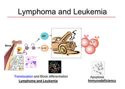 Lymphomas